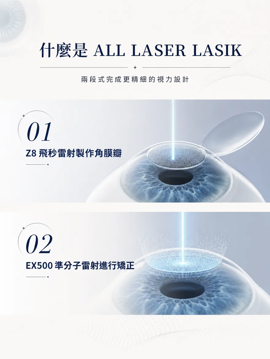 全雷射LASIK — 什麼是 ALL LASER LASIK — 兩段式完成更精細的視力設計:01 Z8飛秒雷射製作角膜瓣、02 EX500準分子雷射進行矯正。
