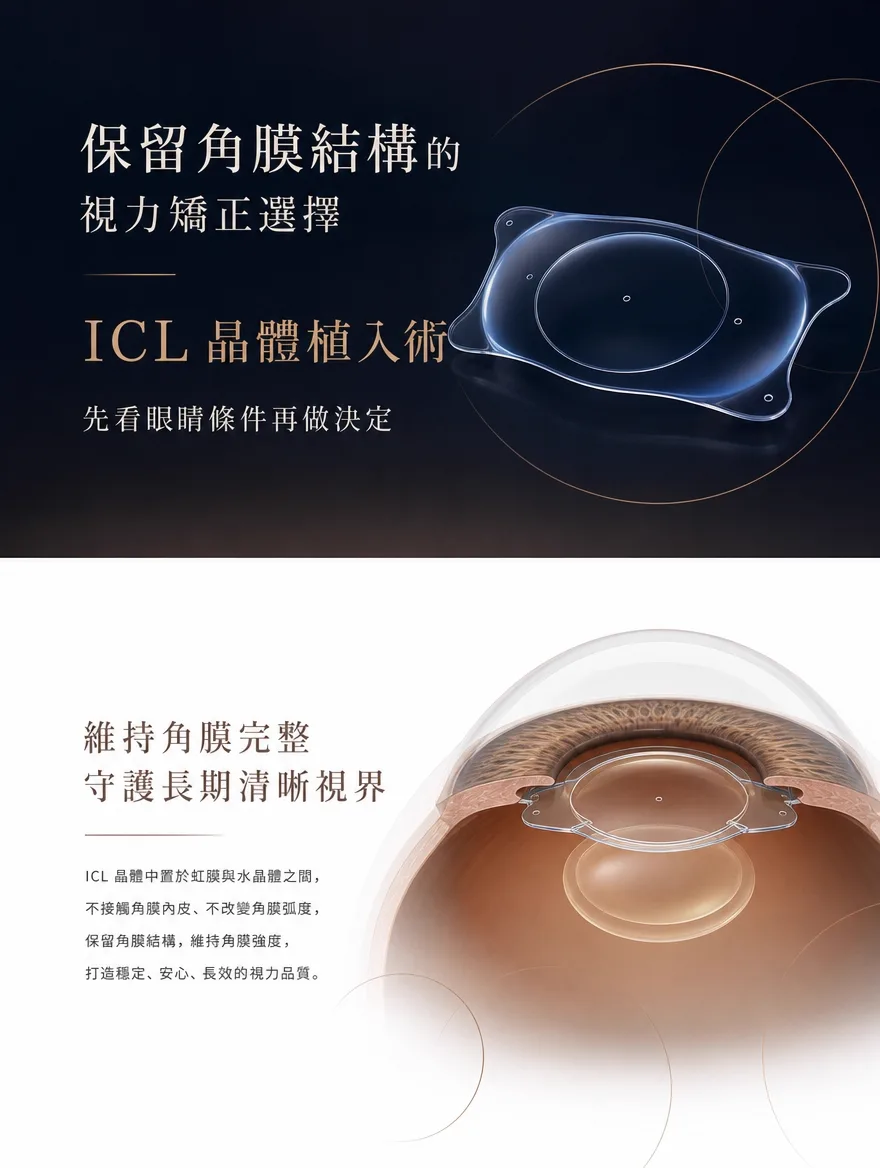 眼內鏡片植入術（ICL） — 保留角膜結構的視力矯正選擇 — ICL 晶體植入術 — 先看眼睛條件再做決定。ICL 晶體中置於虹膜與水晶體之間，不接觸角膜內皮、不改變角膜弧度，保留角膜結構，維持角膜強度，打造穩定、安心、長效的視力品質。