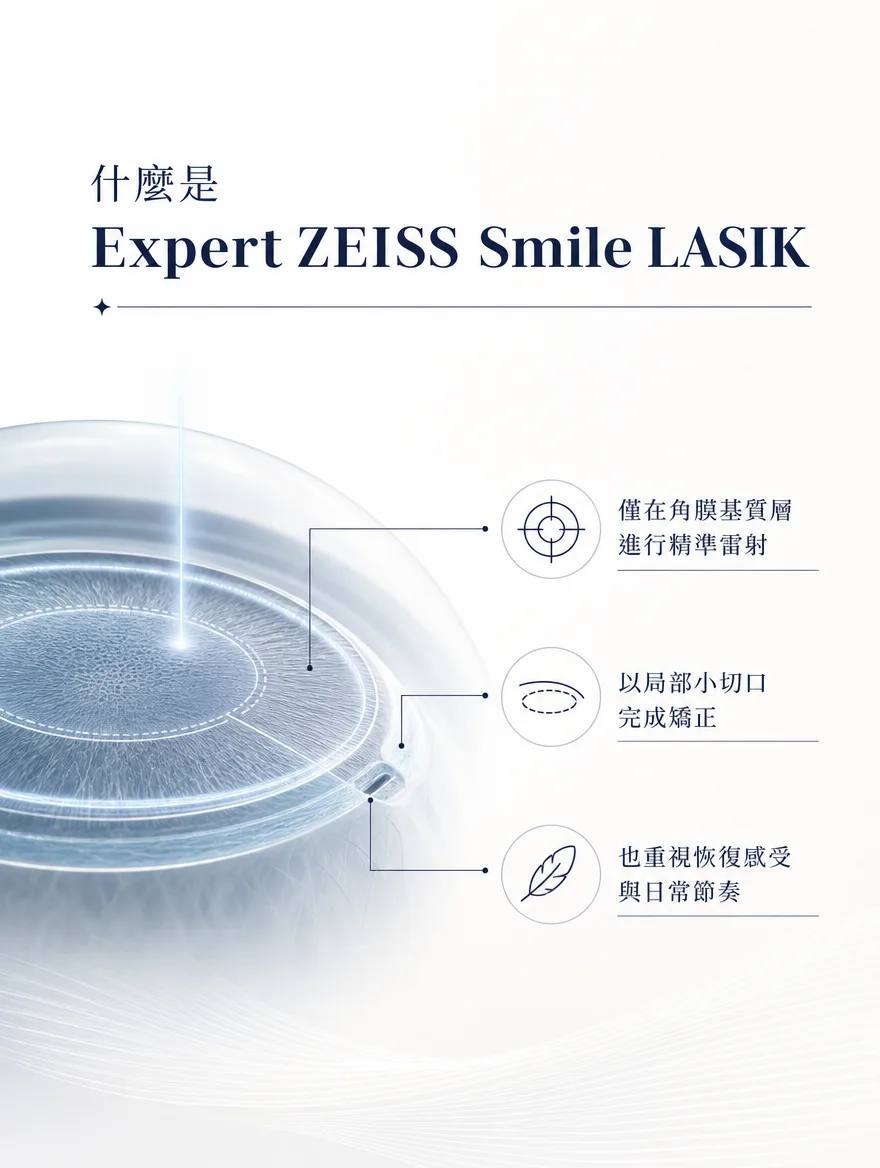 ZEISS SMILE LASIK — 什麼是 Expert ZEISS Smile LASIK — 僅在角膜基質層進行精準雷射.以局部小切口完成矯正.也重視恢復感受與日常節奏。