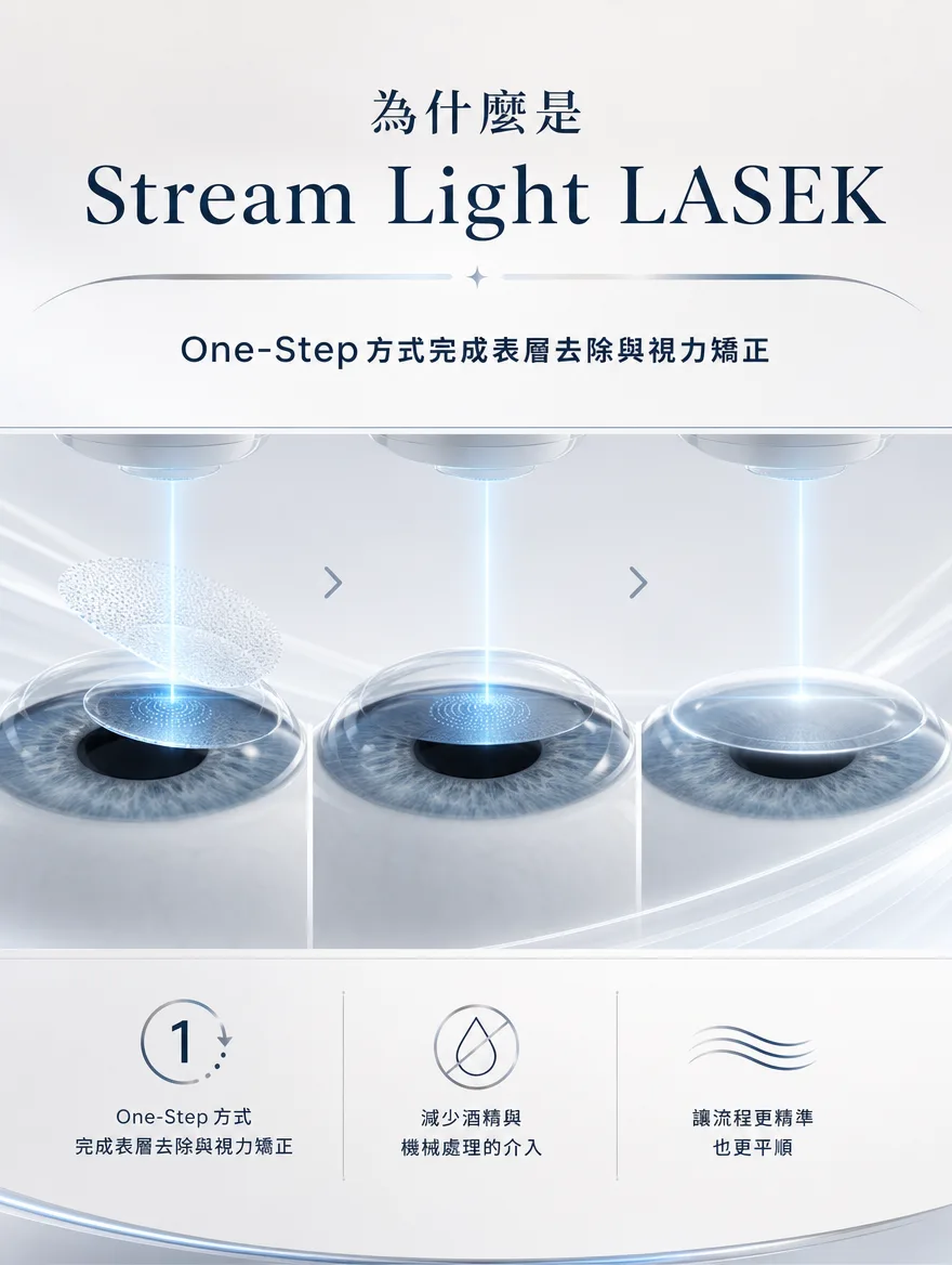 StreamLight 經上皮雷射(LASEK) — Stream Light LASEK — One-Step方式完成表層去除與視力矯正,減少酒精與機械處理的介入,讓整個流程更精準也更平順。